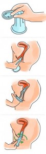 colocar-condon-femenino